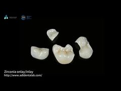 Διαφανές Onlay Zirconia Inlay για μακροχρόνια αντοχή σε λεκέδες και φθορά