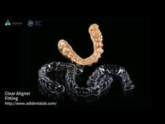 A Closer Look: Customizable Invisible Aligner Clear Aligner With Shorter Treatment Time