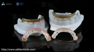 China Dental Lab Αποκαταστάσεις ακριβείας