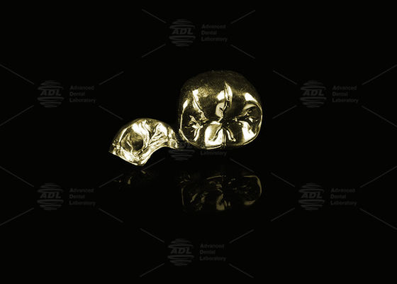 Αγορά Πολύτιμο κράμα Κίτρινο χρυσό 60% πλήρης μεταλλική κορώνα χρυσό φινίρισμα πλήρης μεταλλική κορώνα ηλεκτρονική κατασκευή