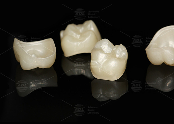 Αγορά Φυσικό πλήρες περίγραμμα Zirconia Crown Precise Fit Full Contour Οδοντιατρικό Εργαστήριο ηλεκτρονική κατασκευή