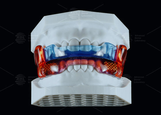 Αγορά Ιατρική ποιότητα Σιλικόνη Αντι- ροχαλητικό Εργαλείο RP Για Βελτίωση του Νυμίου ηλεκτρονική κατασκευή