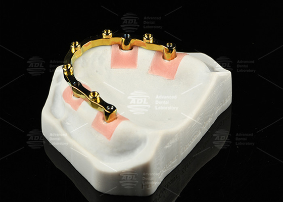 Αγορά Τιτανίου Sandblasted Implant Locator Bar Ασημένιο χρυσό οδοντικό εμβόλιο τοποθετητή προσαρμογή ηλεκτρονική κατασκευή
