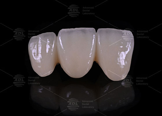 Αγορά China Dental Lab Accurate Precision Of Margin Layered Zirconia Υποαλλεργικό βιοσυμβατό οδοντικό υλικό για ανθεκτικό και αποκαταστατικό ηλεκτρονική κατασκευή