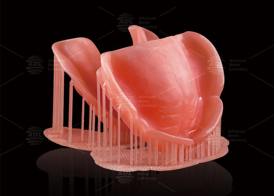 CAD/CAM Ψηφιακές αφαιρούμενες μερικές οδοντοστοιχίες Deep Pink Τυπωμένες από υπολογιστή οδοντοστοιχίες