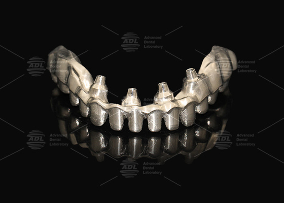 Υβριδικό ροζ πορσελάνινο εμφύτευμα Crown Malong Full Arch Implant Bridge άμεση φόρτωση