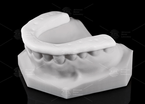 Ανθεκτικότητα και αναπνευσσιμότητα 3D εκτυπωμένο νάιλον οκλουσιακό σφεντόνι / νυχτερινός φύλακας για ενεργό τρόπο ζωής