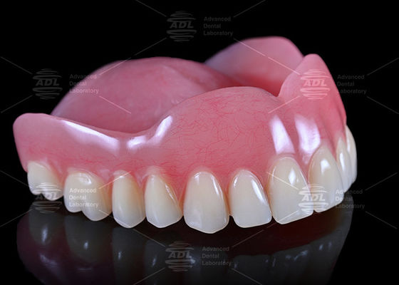 China Dental Lab High Esthetics Customized Full Acrylic Denture Full Service for Worldwide