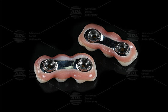 Ενισχυτική ράβδο εμφυτεύματος CAD CAM Σχεδιασμένη για ακριβή προσαρμογή συμβατή με τα περισσότερα συστήματα εμφυτεύματος δοντιών που εξασφαλίζουν λύσεις αποκατάστασης των δοντιών Κινέζικο οδοντιατρικό εργαστήριο